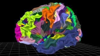 Multi-layered &#39;live&#39; map of the human brain becomes a new diagnostic tool to help study mental illness