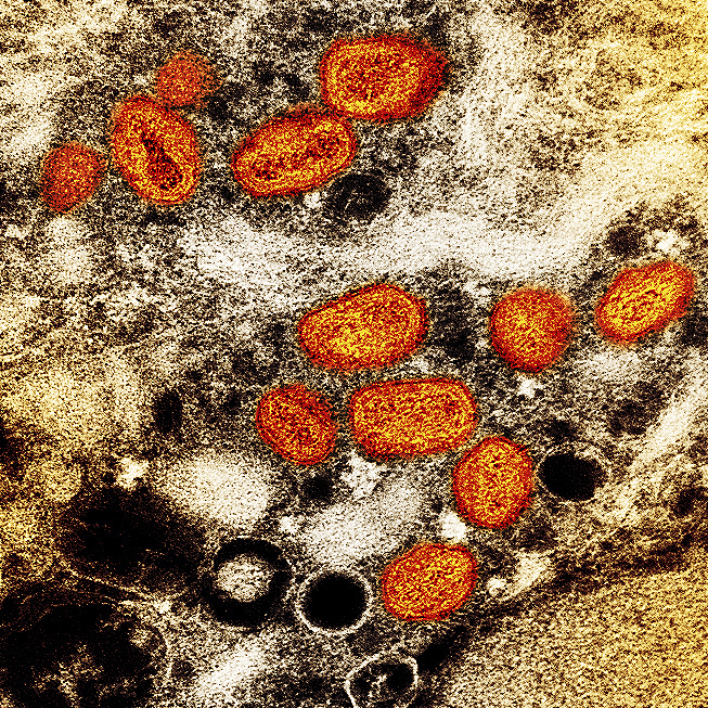 Color transmission electron micrograph of monkeypox particles (orange) found in laboratory-grown infected cells (brown) in Maryland, U.S., July 26, 2022. Visual China Figure